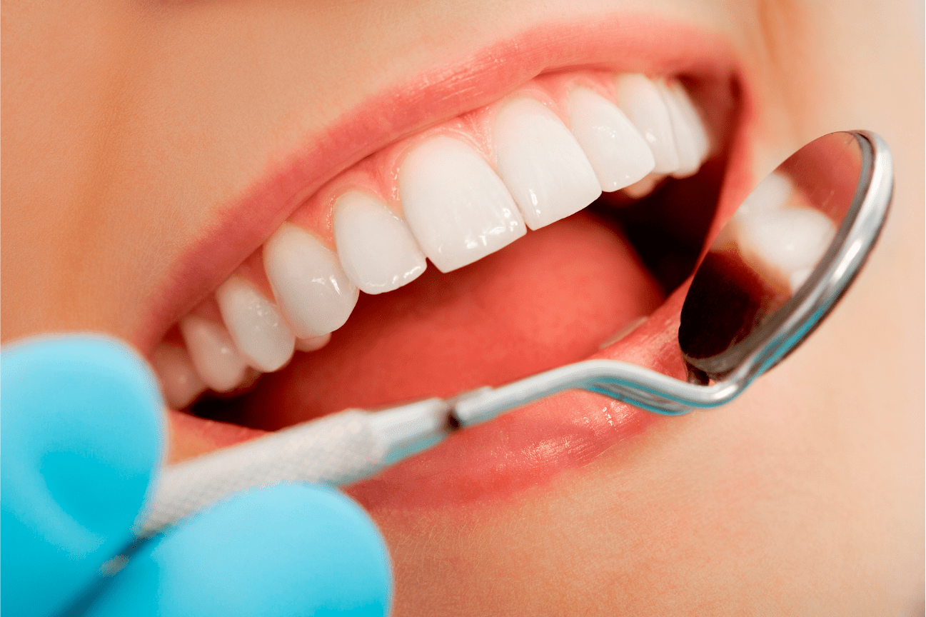 estetica dental 2